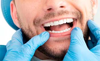 Diferencia entre estética dental y cosmética dental